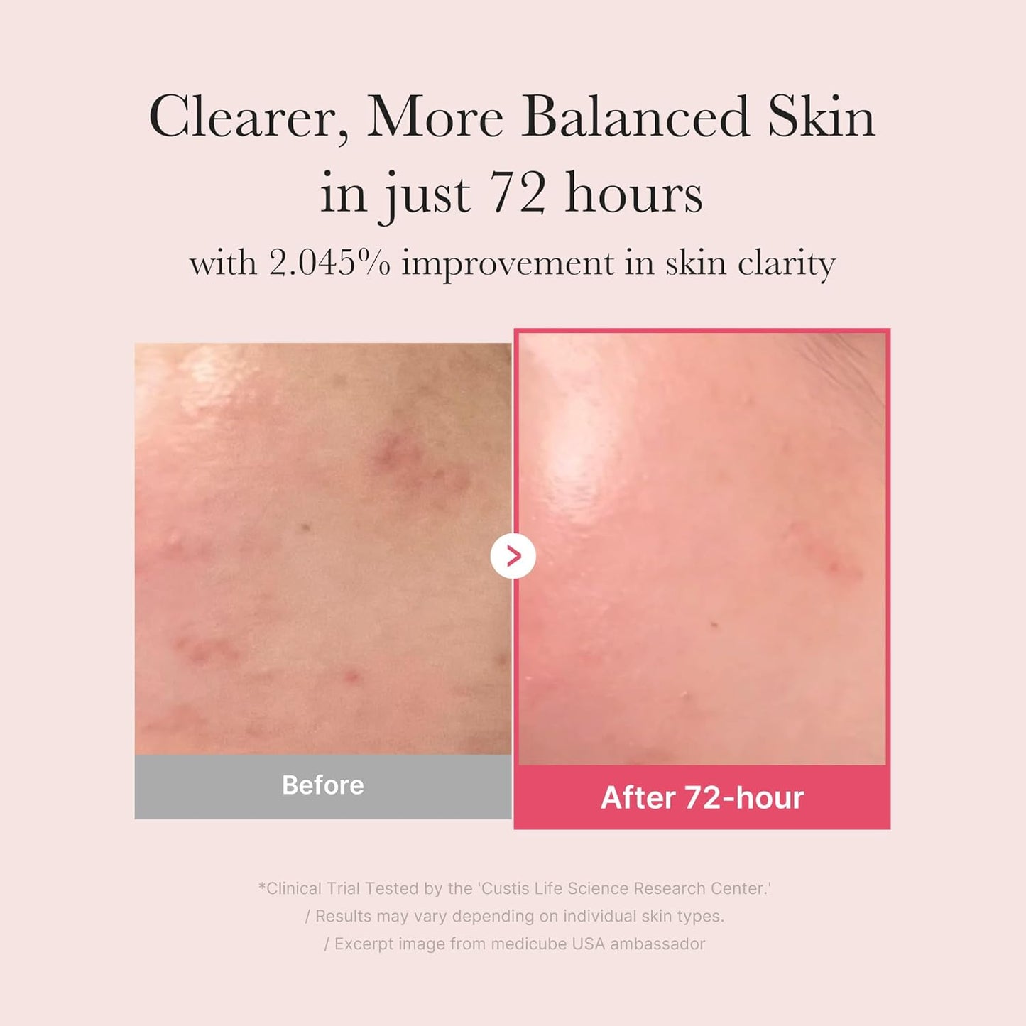 Medicube TXA Niacinamide Capsule Cream + TXA Niacinamide 15% Serum