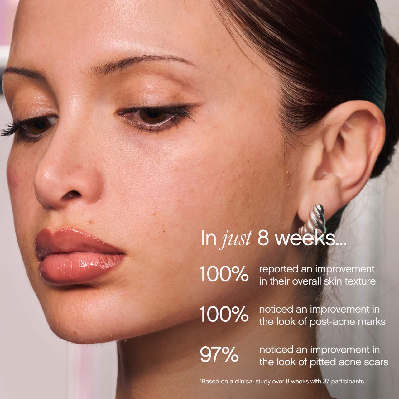 Topicals Sealed Active Scar Filling Primer for Acne Prone Skin
