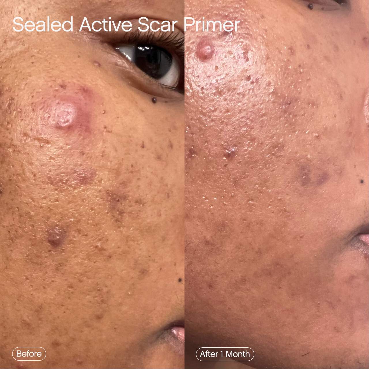 Topicals Sealed Active Scar Filling Primer for Acne Prone Skin