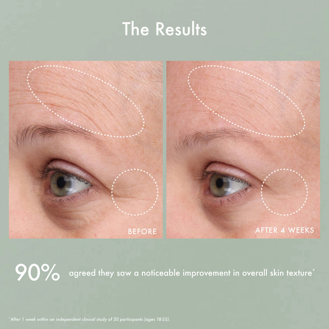 Summer Fridays Gentle Reset Daily Exfoliating Pads to Smooth + Minimize Pores