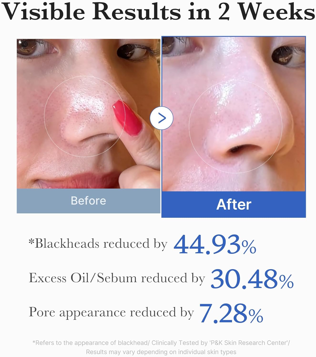 Medicube Zero Pore Pad