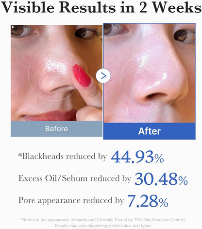 Medicube Zero Pore Pad