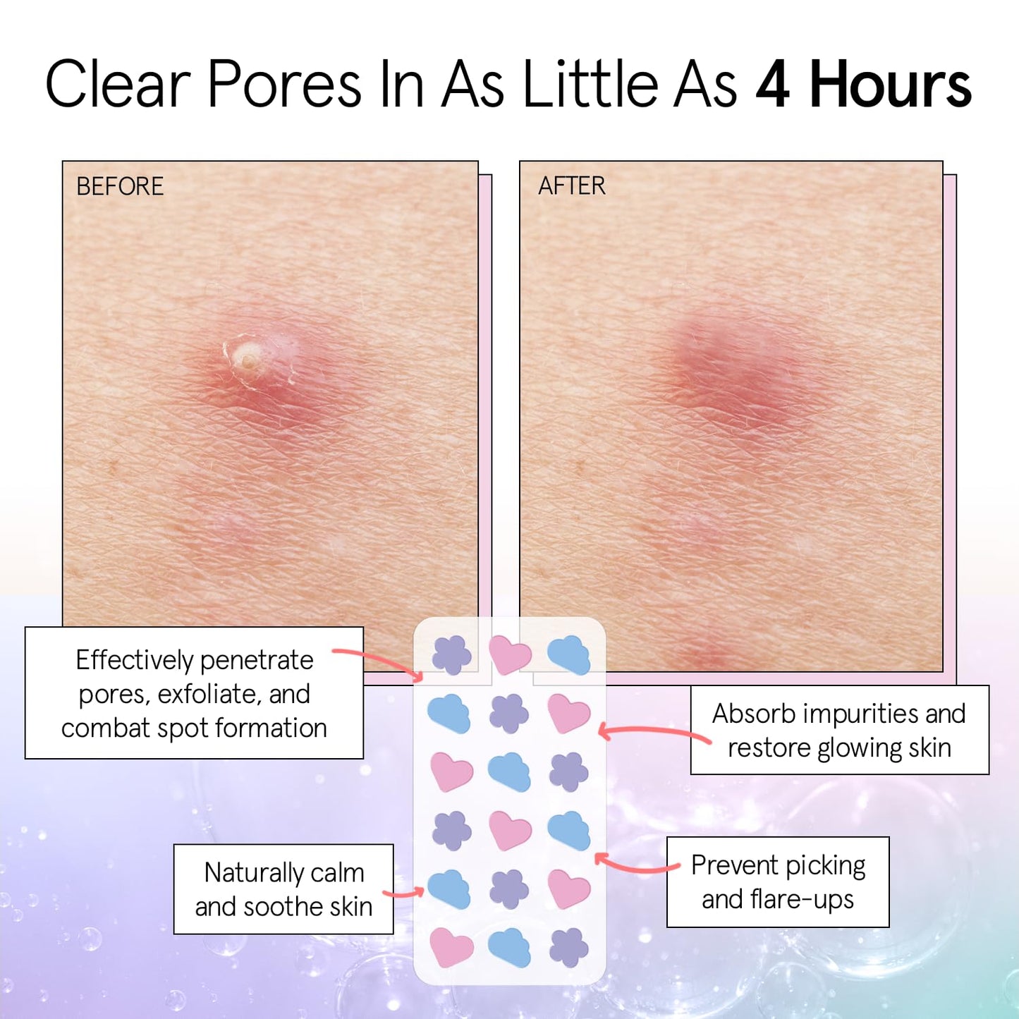 Grace & Stella Hydrocolloid Pimple Patches