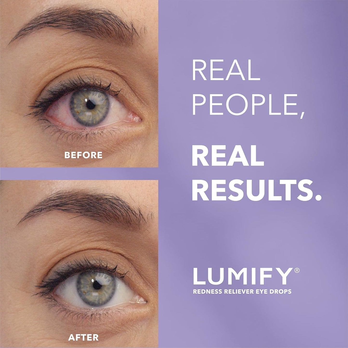 LUMIFY Brimondine Tartrate Ophthalmic Solutions 0.25% Redness Reliever Eye Drops