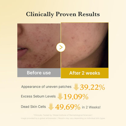 Medicube Kojic Acid Turmeric Pads