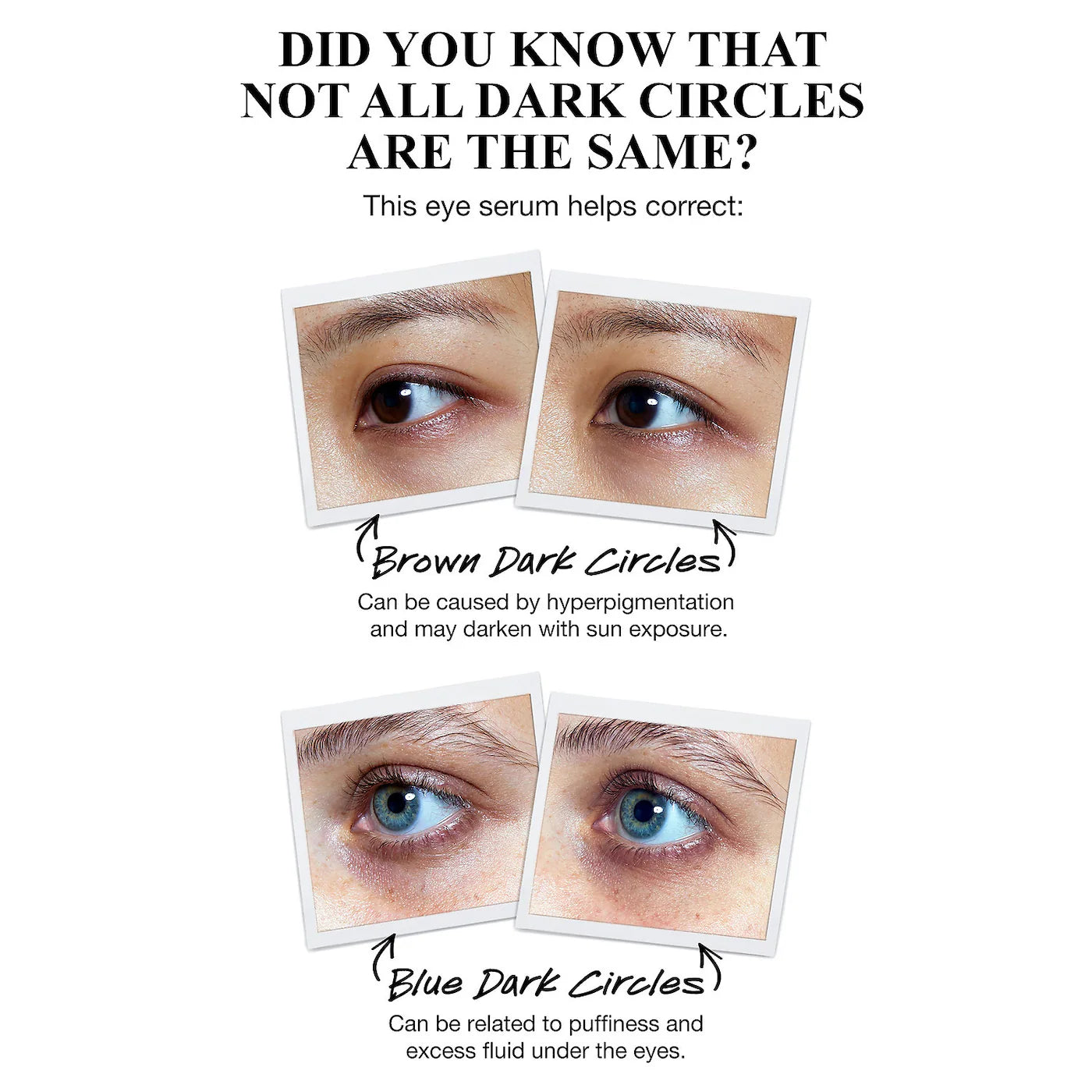 Kiehl's Powerful-Strength Dark Circle Reducing Vitamin C Eye Serum