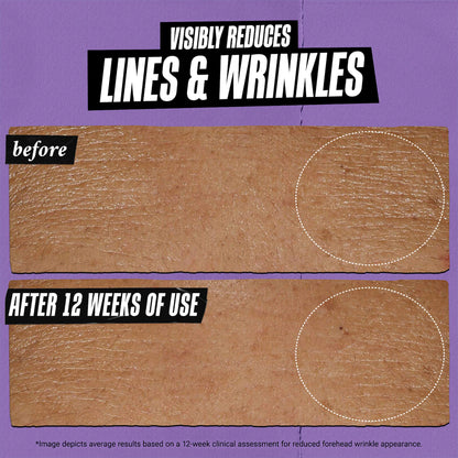 Kiehl's Micro-Dose Anti-Aging Retinol Serum