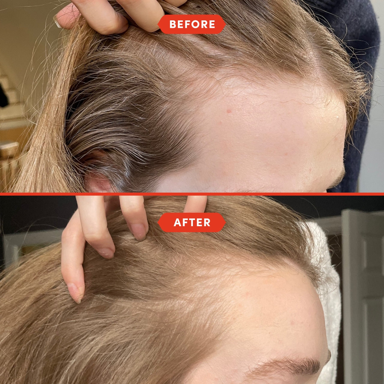 Fable & Mane HoliRoots™ Pre-Wash Treatment Oil for Thinning Hair