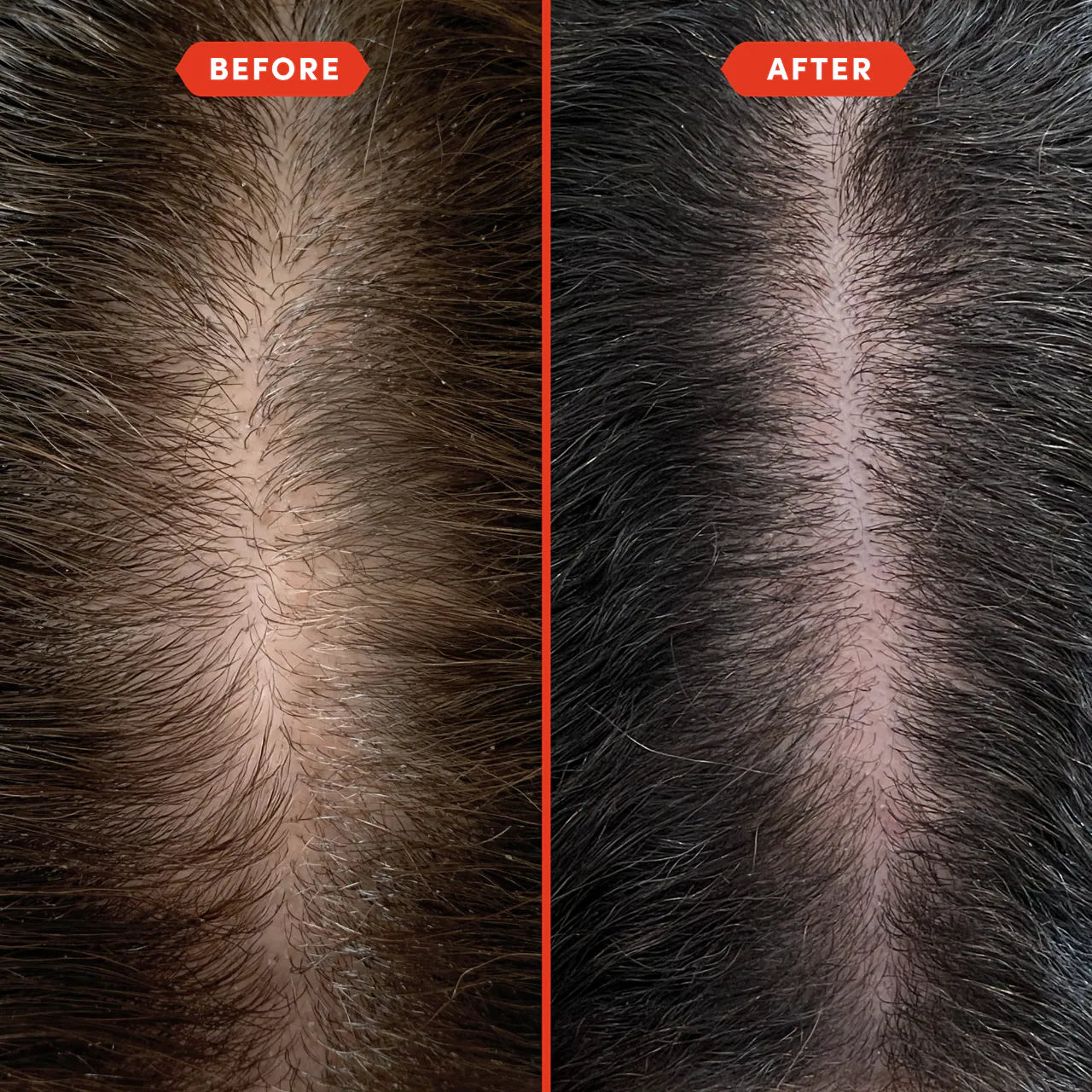 Fable & Mane HoliRoots™ Pre-Wash Treatment Oil for Thinning Hair