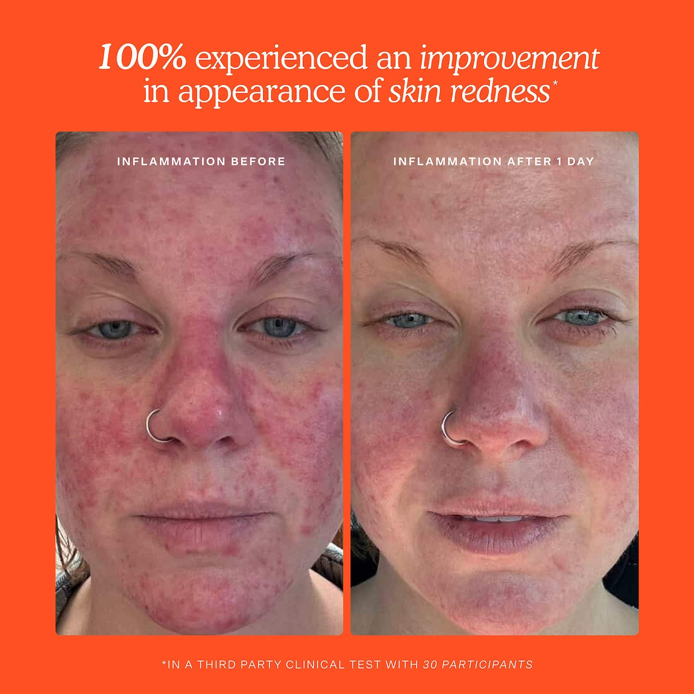 Tower 28 Mini SOS Daily Hypochlorous Acid Spray