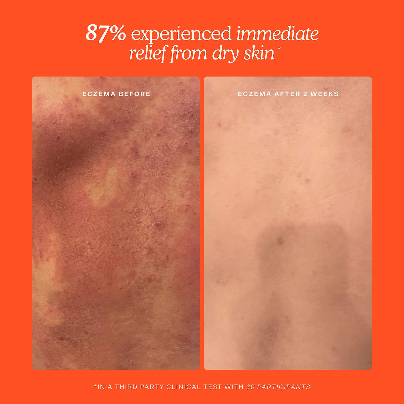 Tower 28 Mini SOS Daily Hypochlorous Acid Spray