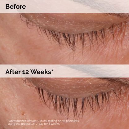 The Ordinary Multi-Peptide Lash and Brow Serum