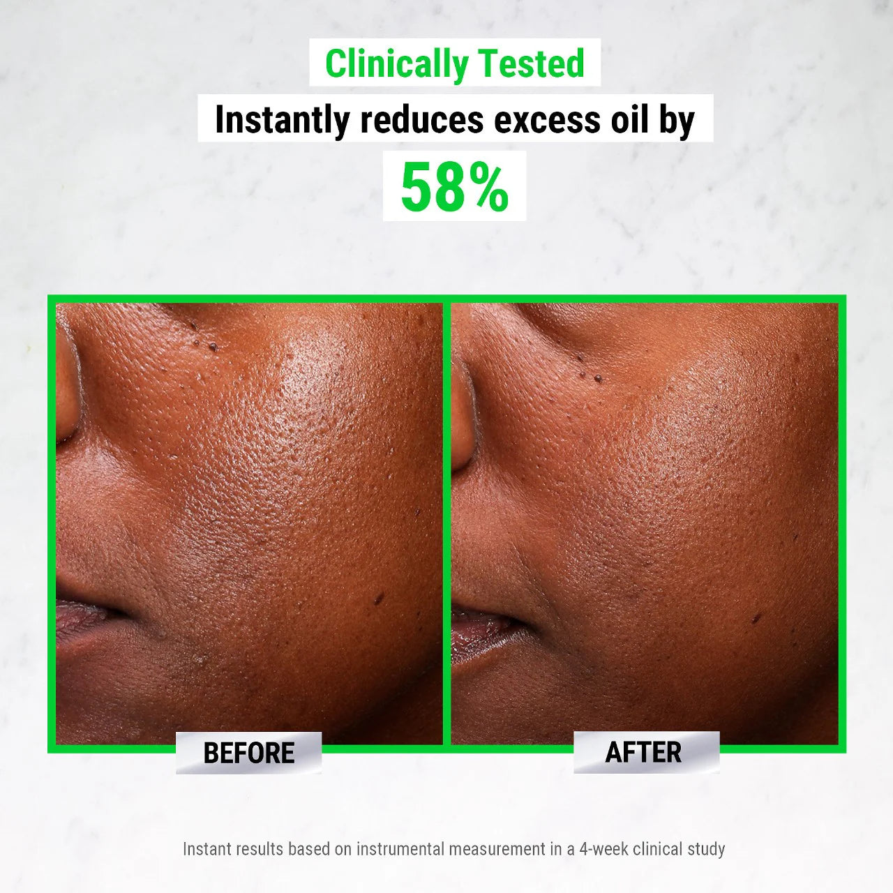 Kiehl's Since 1851 Ultra Pure High-Potency 5.0% Niacinamide Serum