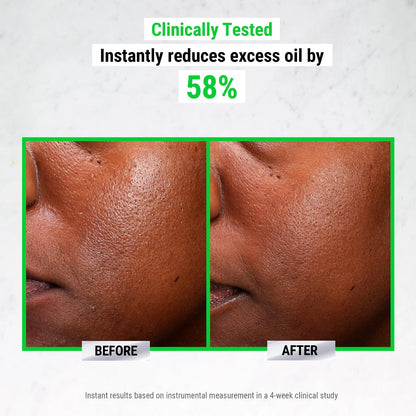 Kiehl's Since 1851 Ultra Pure High-Potency 5.0% Niacinamide Serum