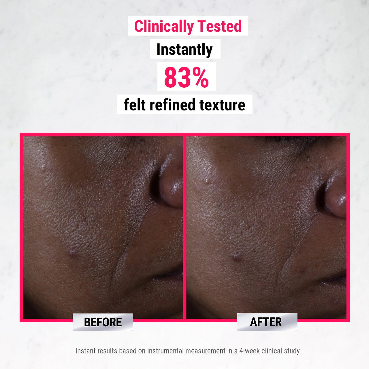 Kiehl's Ultra Pure High-Potency 9.8% Glycolic Acid Serum