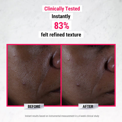 Kiehl's Ultra Pure High-Potency 9.8% Glycolic Acid Serum