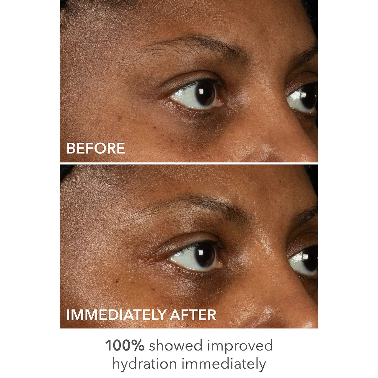 Dr. Dennis Gross Skincare DermInfusions™ Lift + Repair Eye Mask