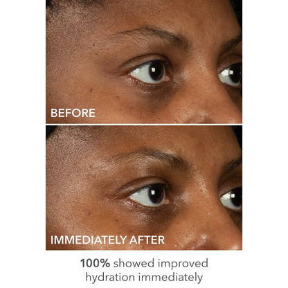Dr. Dennis Gross Skincare DermInfusions™ Lift + Repair Eye Mask