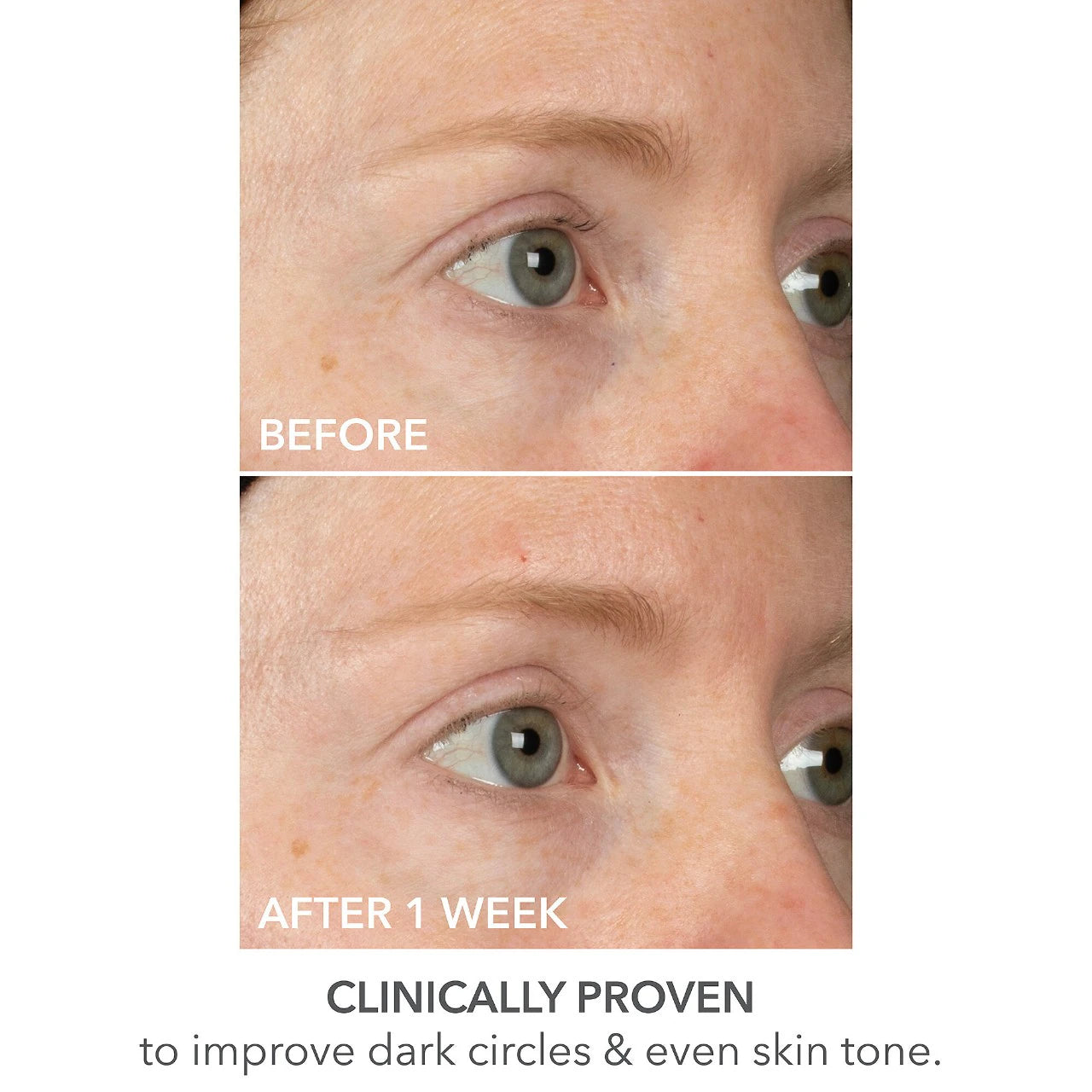 Dr. Dennis Gross Skincare DermInfusions™ Lift + Repair Eye Mask