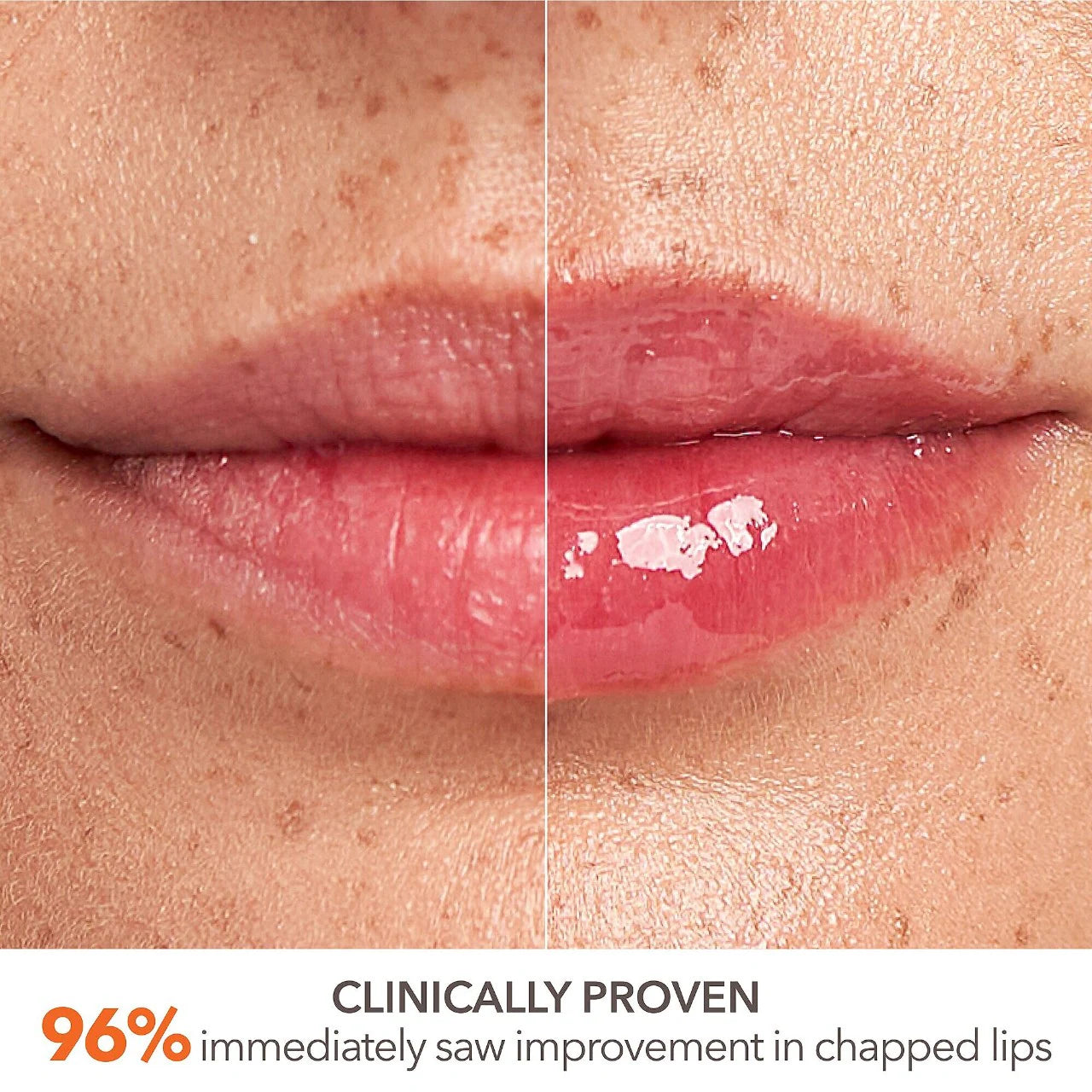 Dr. Dennis Gross Skincare DermInfusions™ Plump + Repair Lip Treatment