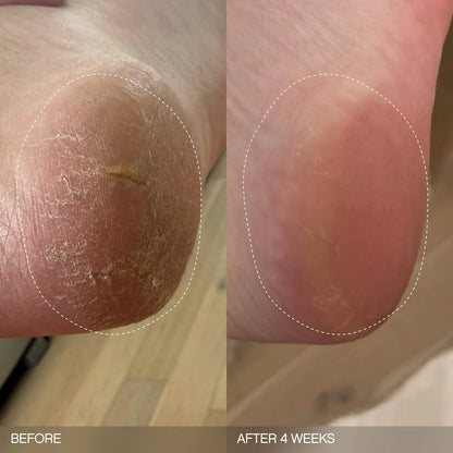 Topicals Slather Exfoliating & Smoothing Bar