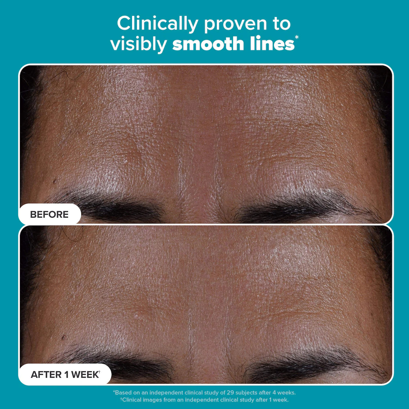 Paula's Choice Skin Perfecting 2% BHA Exfoliating Toner Pads