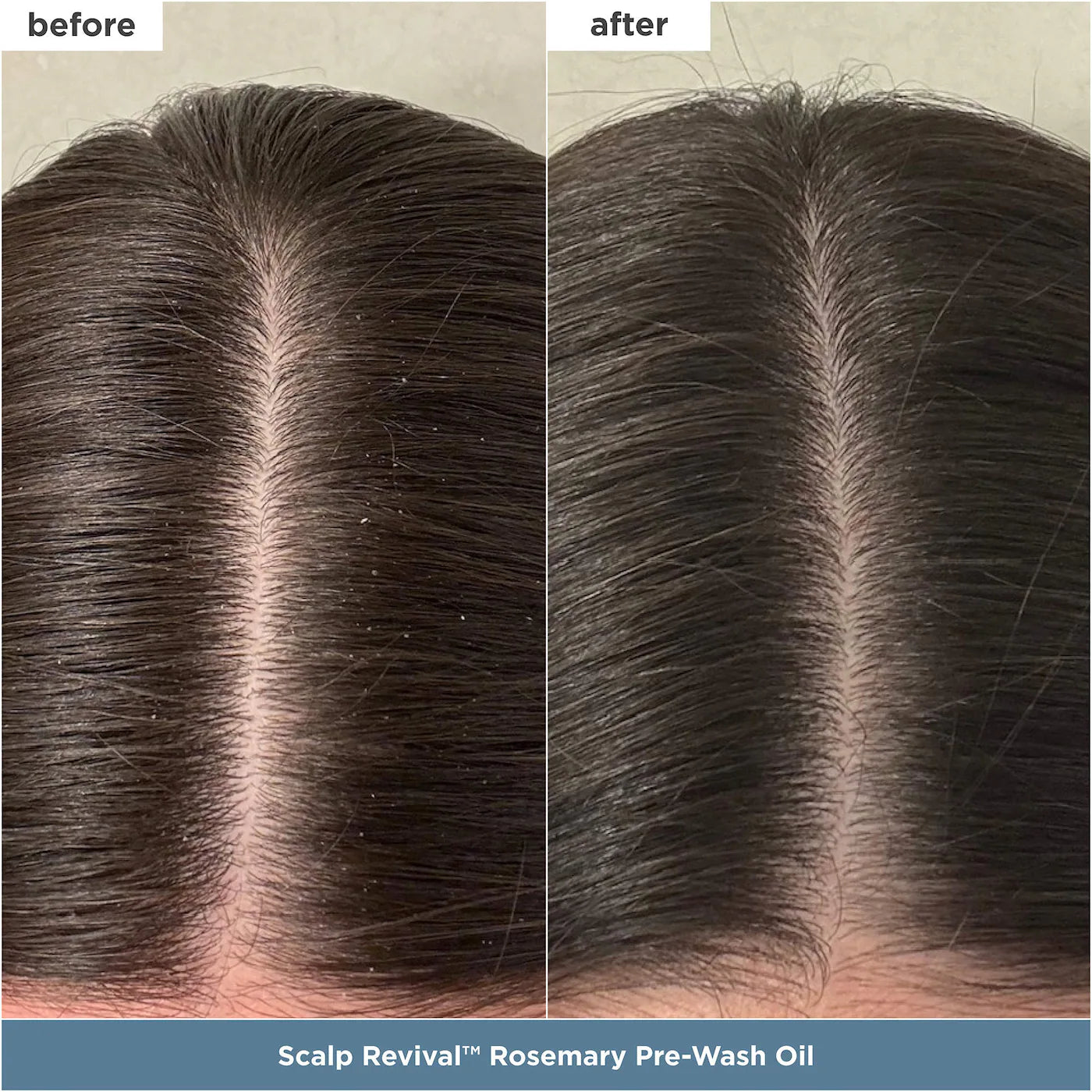 Briogeo Healthy Hair Delights Gift Set