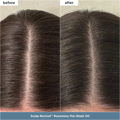 Briogeo Healthy Hair Delights Gift Set