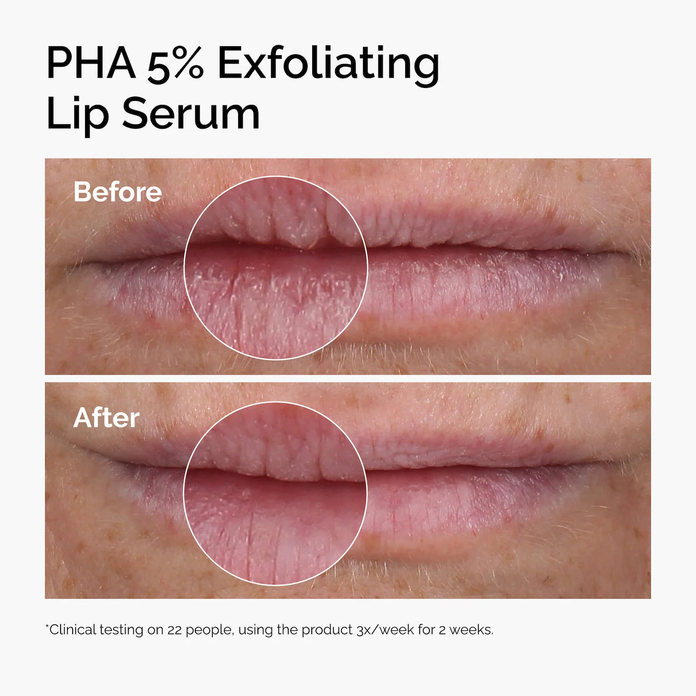 The Ordinary PHA 5% Exfoliating Lip Serum