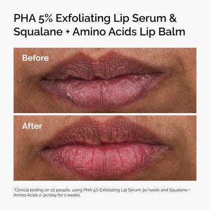 The Ordinary PHA 5% Exfoliating Lip Serum