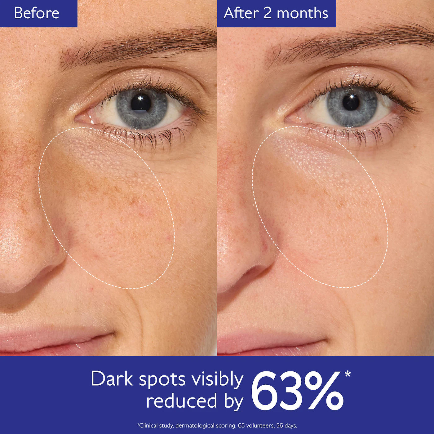 Caudalie Vinoperfect Brightening Dark Spot Serum Vitamin C Alternative