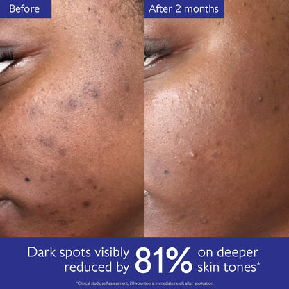 Caudalie Vinoperfect Brightening Dark Spot Serum Vitamin C Alternative