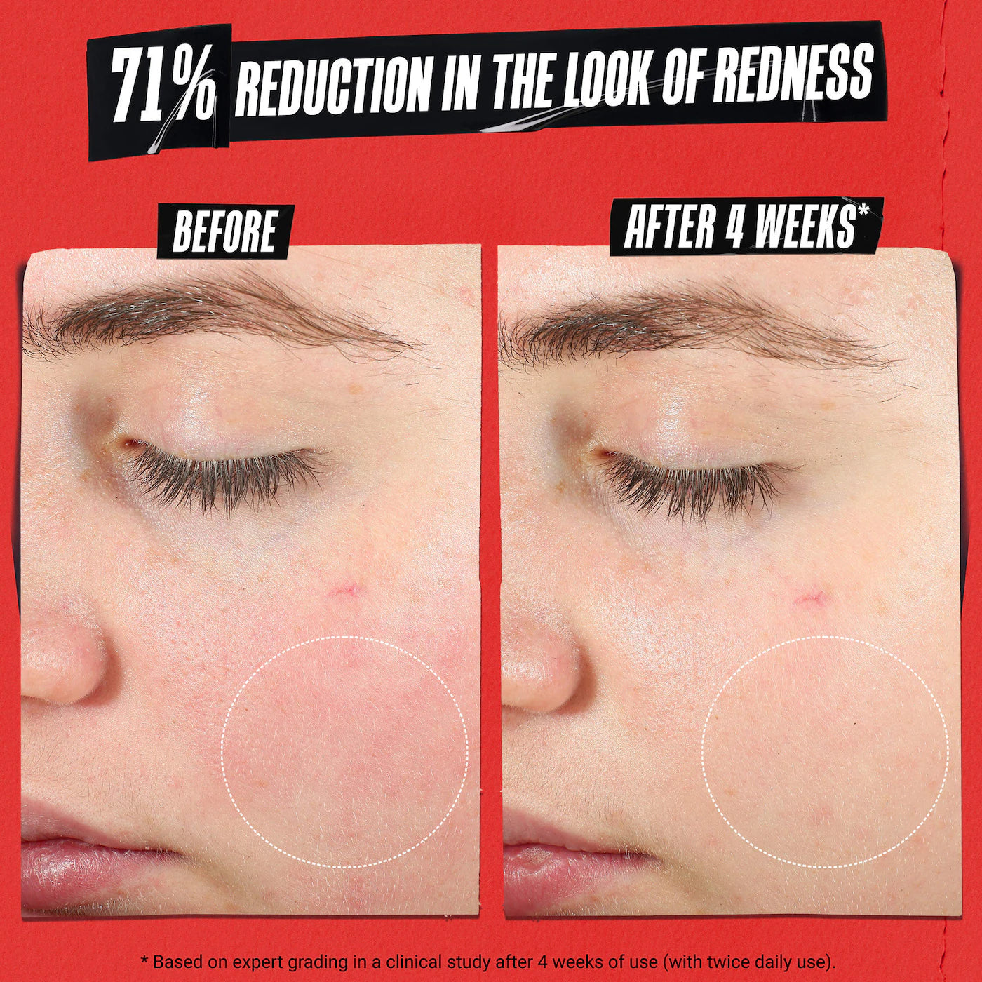 Kiehl's Ultra Facial Meltdown Recovery Medicated Cream