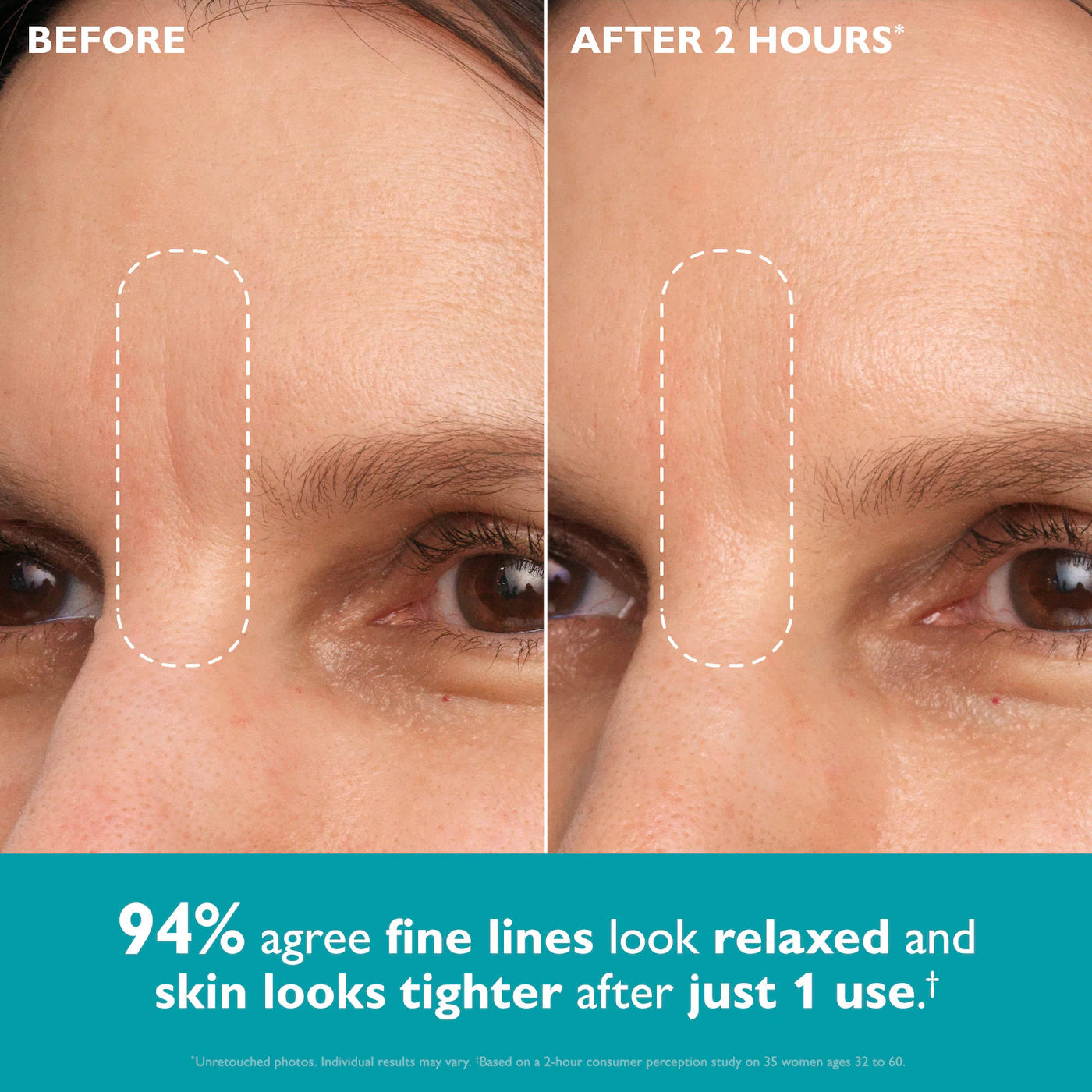 Peter Thomas Peptide Skinjection™ Peptide-Infused Face & Eye Tape