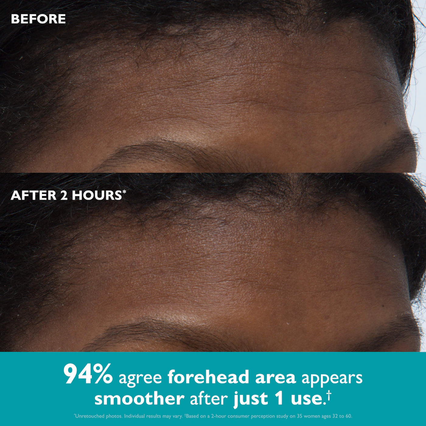 Peter Thomas Peptide Skinjection™ Peptide-Infused Face & Eye Tape