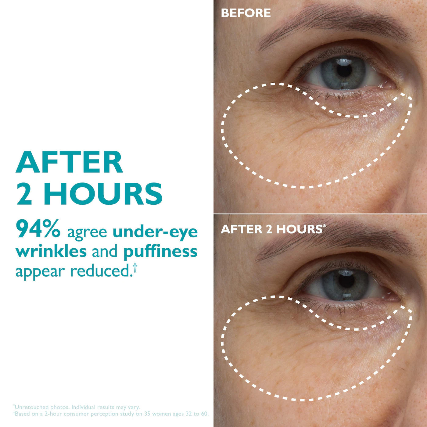 Peter Thomas Peptide Skinjection™ Peptide-Infused Face & Eye Tape