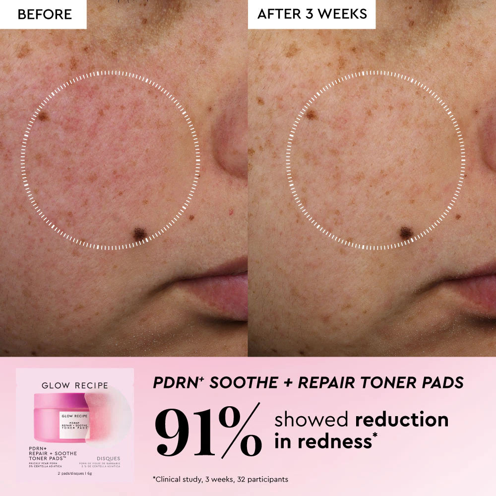 Glow Recipe Korean Toner Pad Skin Care Kit