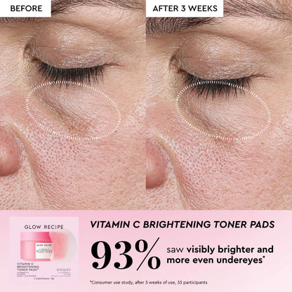 Glow Recipe Korean Toner Pad Skin Care Kit