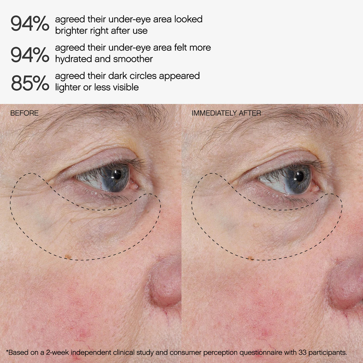 Topicals Faded Under Eye Brightening & Clearing Eye Masks