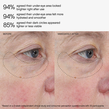Topicals Faded Under Eye Brightening & Clearing Eye Masks