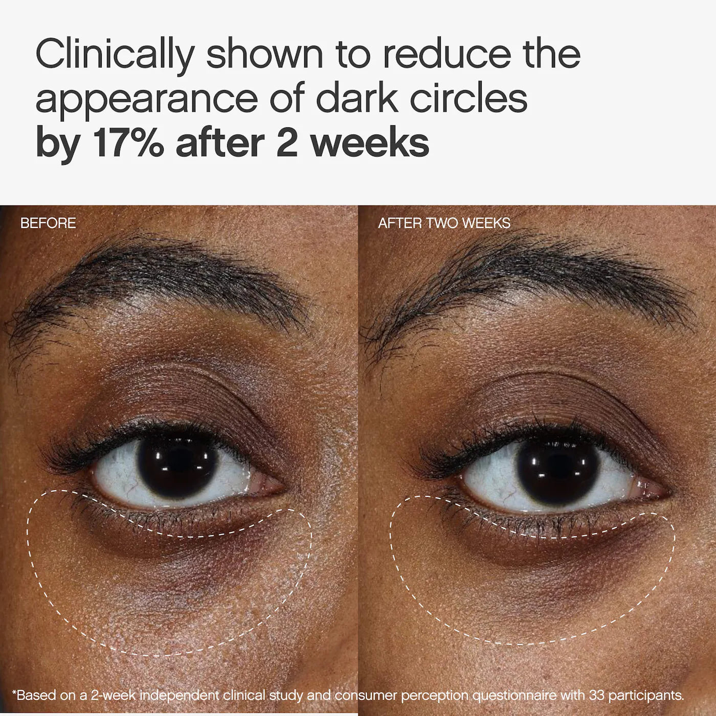 Topicals Faded Under Eye Brightening & Clearing Eye Masks
