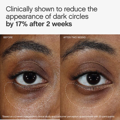 Topicals Faded Under Eye Brightening & Clearing Eye Masks
