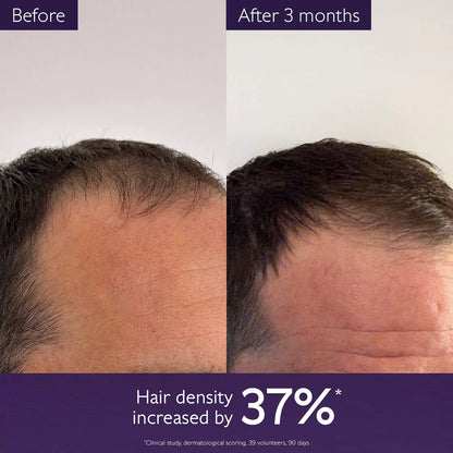 Caudalie Hair Density Serum for Hair Loss & Thinning Hair